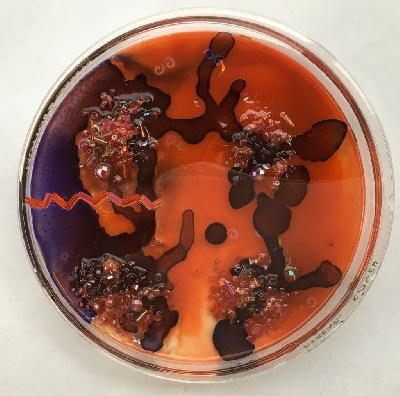 Pilar Pedroza. Medio de Contraste. 